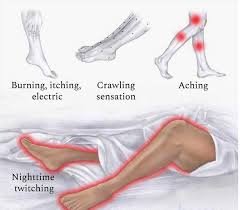 restless legs syndrom